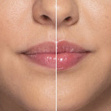 Lip Injection extreme