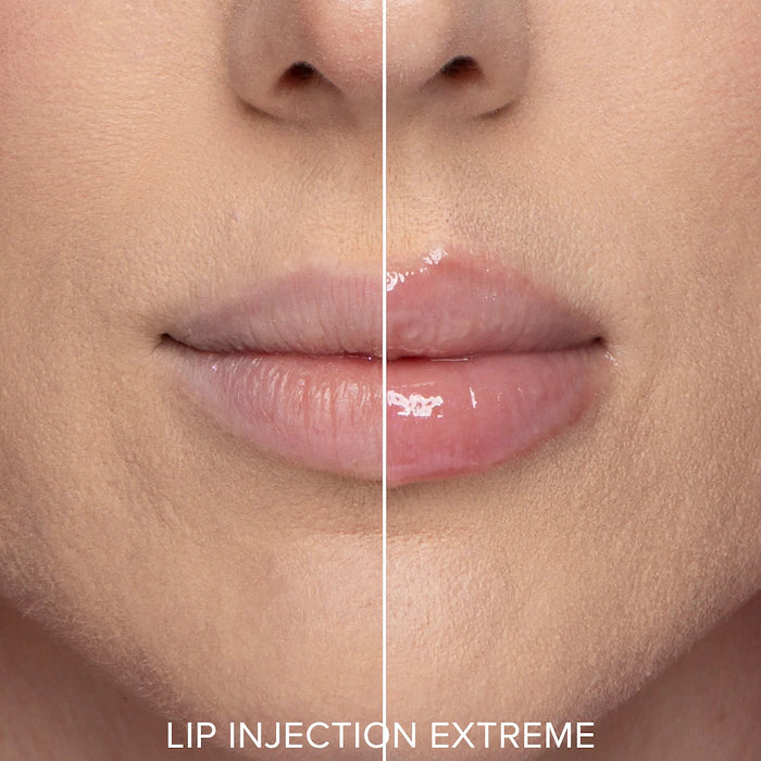 Lip Injection Plump Challenge Instant & Long-Term Lip Plumper Set